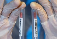 Cercetătorii lucrează la un vaccin împotriva hantavirusului — dar este probabil să mai dureze ani