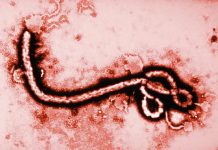 În lume apare din nou un focar de febră Ebola — atât de serios încât OMS a declarat stare de urgență de interes internațional. Cât de periculos este?