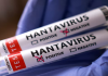 „Nu este un nou COVID”. Șeful OMS a ajuns în Canare pentru evacuarea pasagerilor după un focar de hantavirus